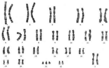 0_171d45bb6e98fe73d70216f67b3df0c2_16412473.jpg.png
