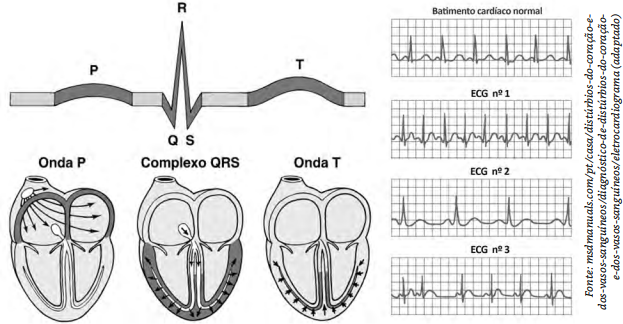 Batimentos Cardiacos Normais Eletrocardiograma Eletrocardiograma ECG 