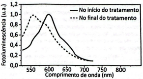 0_c8eb5fb176396df59708fbd7c5a2d6b4_15280394.jpg.png
